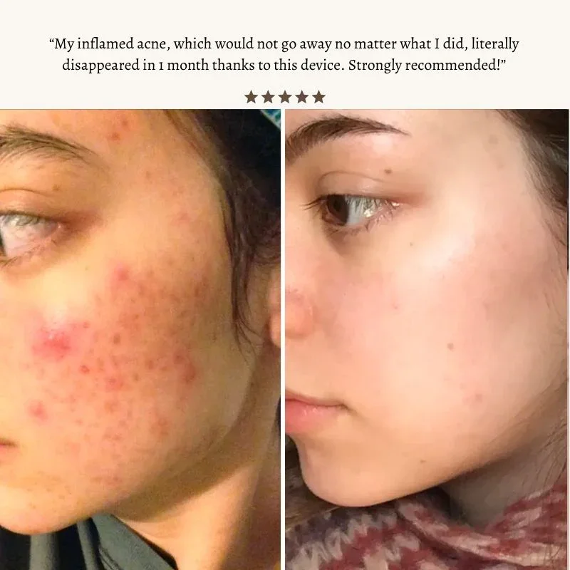 Hexibella Beauty Wand