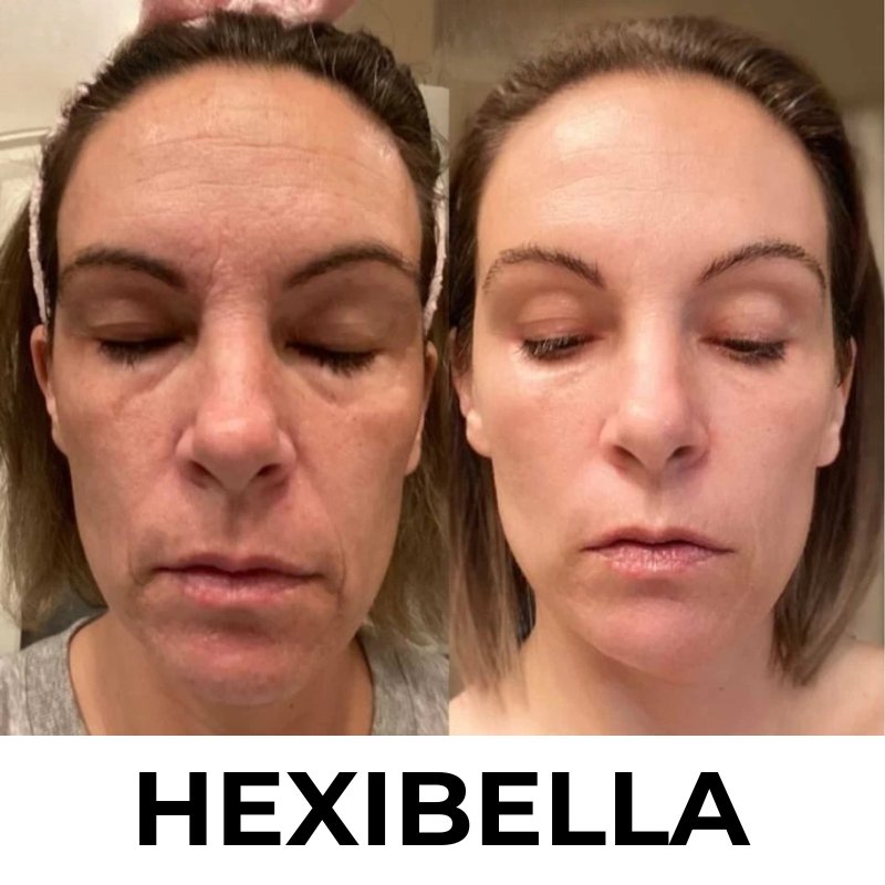 Hexibella MicroGlow Device