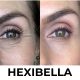 Hexibella MicroGlow Device