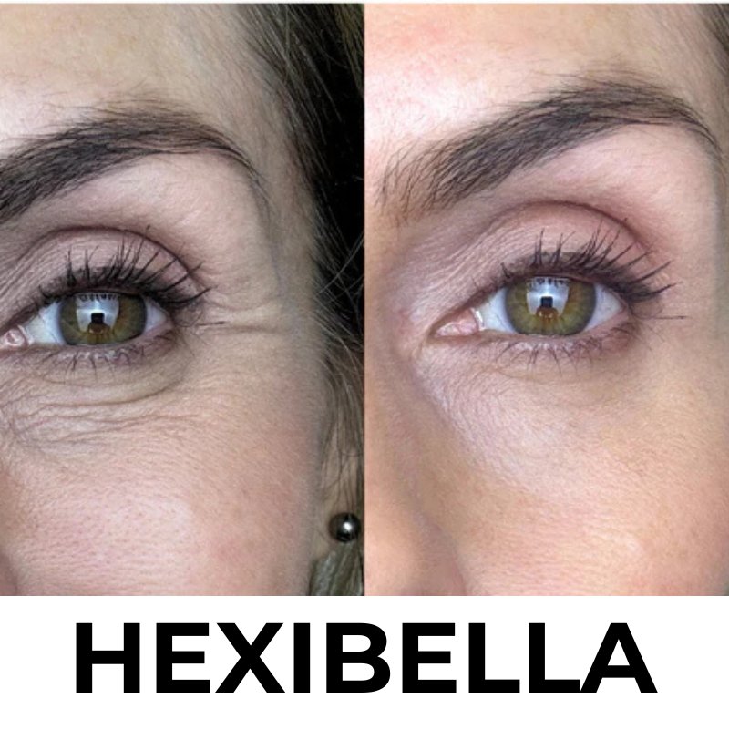 Hexibella MicroGlow Device