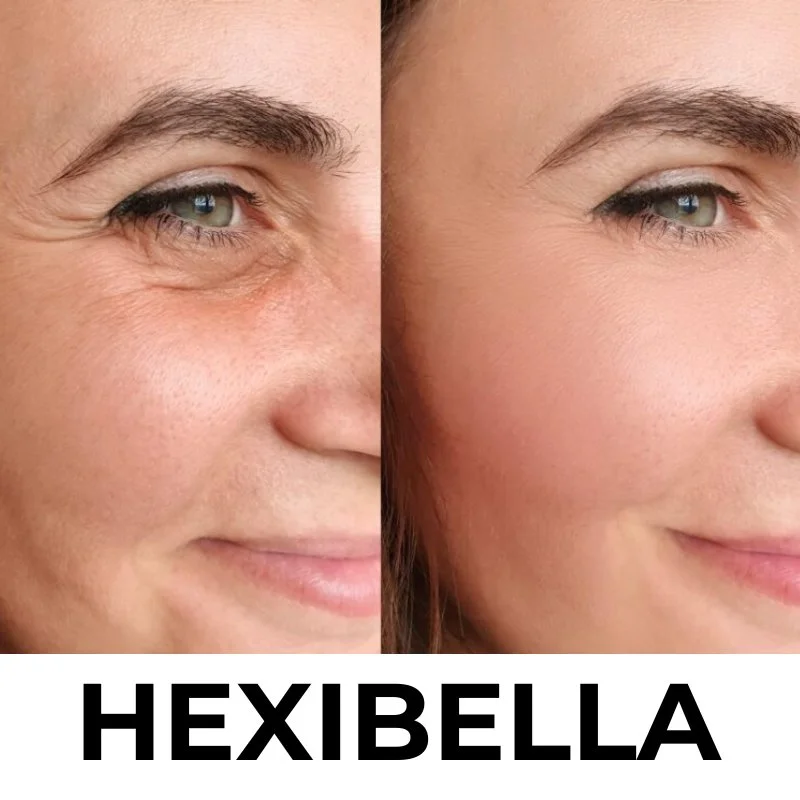 Hexibella Red Light Device