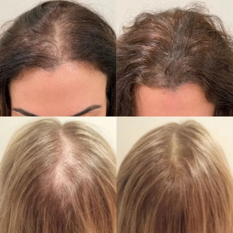 Serum do włosów Hexibella 5 w 1