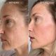 Hexi Copper Peptide Serum
