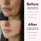 Collagen Niacinamide Jelly + Free Mask