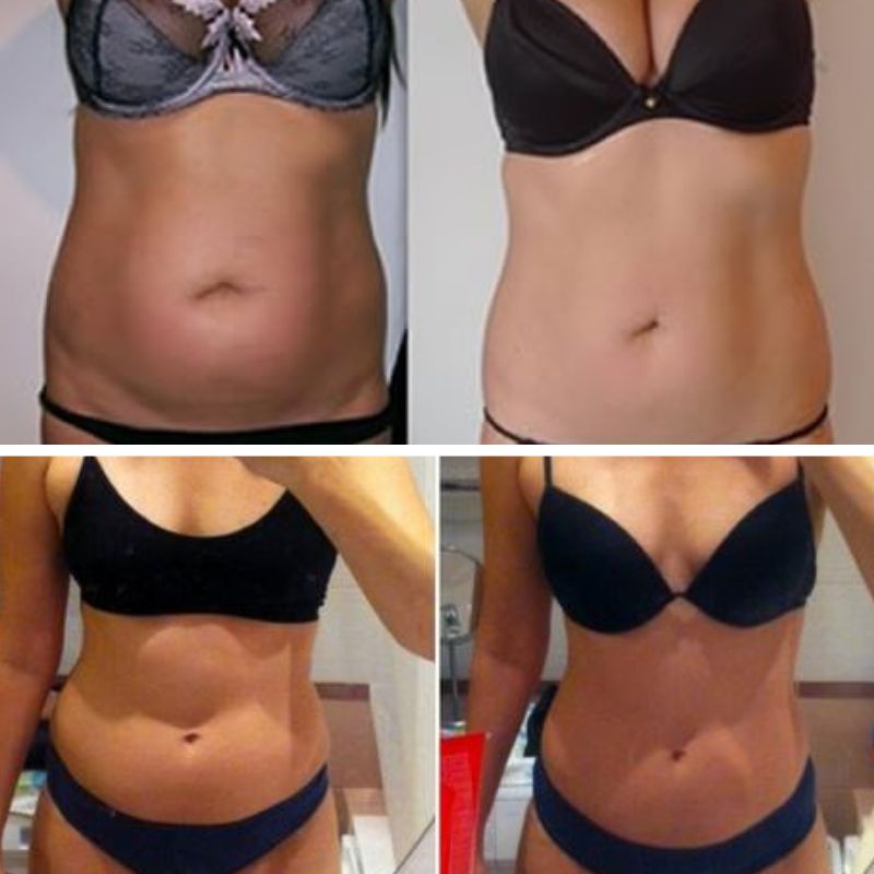 Hexi Body Toner