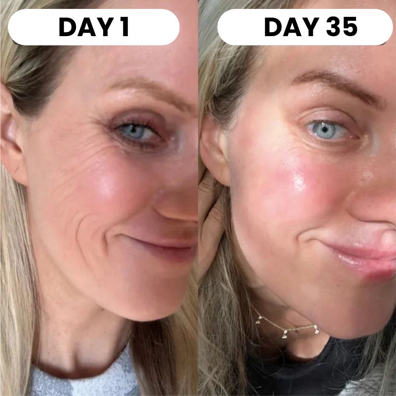 Red Light Therapy Set